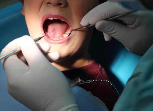 Dental gold may be used for fake teeth and fillings.